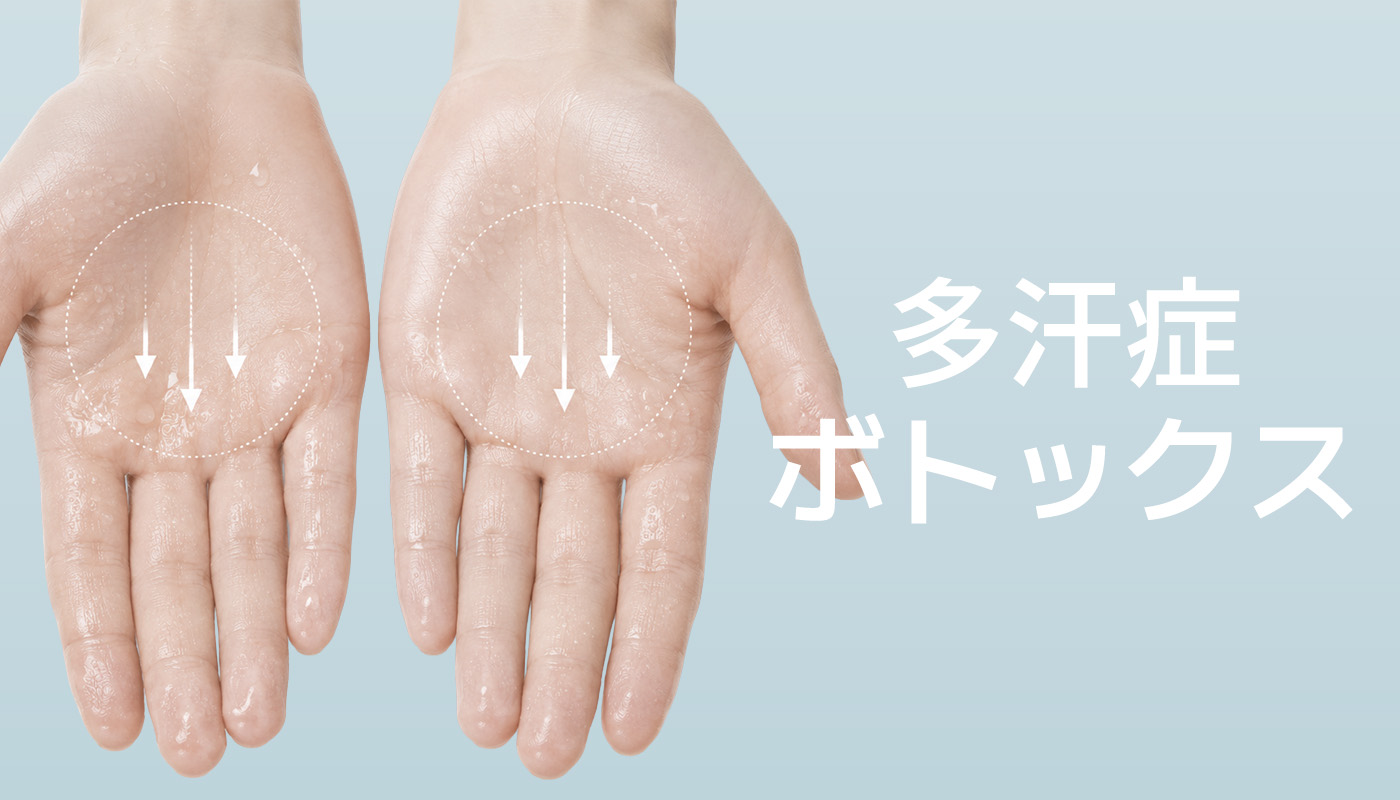 ビューティーオンクリニック東京銀座院 :: 多汗症ボトックス